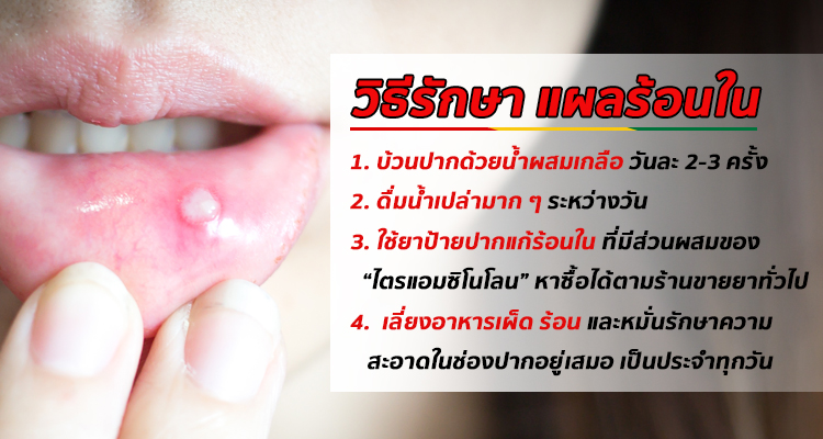 อาการร้อนใน