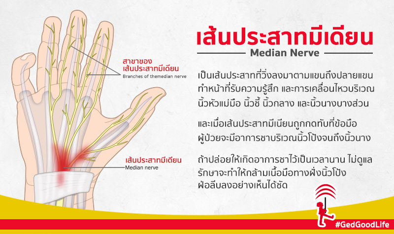 อาการประสาทมือชา