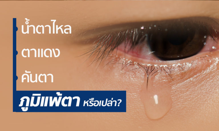 โรคภูมิแพ้ขึ้นตา