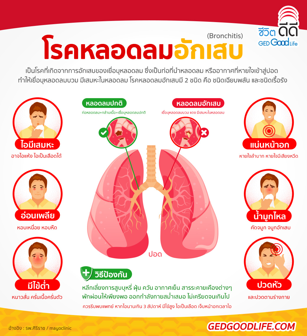 โรคหลอดลมอักเสบ มีกี่ชนิด อาการ และวิธีป้องกันโรค