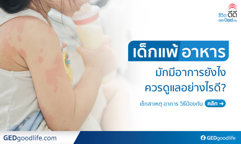 ภูมิแพ้อาหารในเด็ก